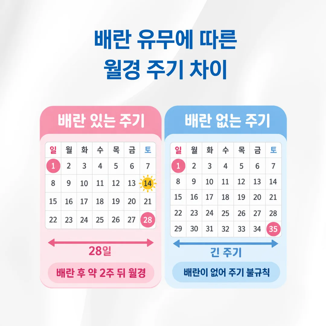 다낭성난소증후군 주기 기록 달력 비교 도식